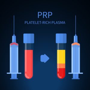 Hyaluronic Acid Viscosupplementation Or Platelet Rich Plasma For Knee ...